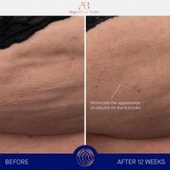 Augustinus Bader The Body Cream 200 Ml -Hochwertiger Kosmetikladen 1367021 Augustinus Bader The Body Cream 200 ml.4ce67bfe